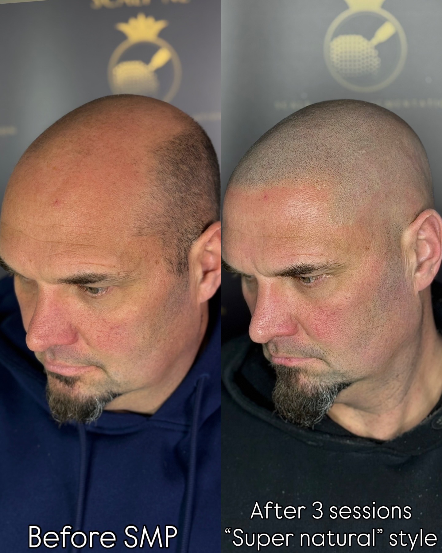 MHP resultaat Shaven Look