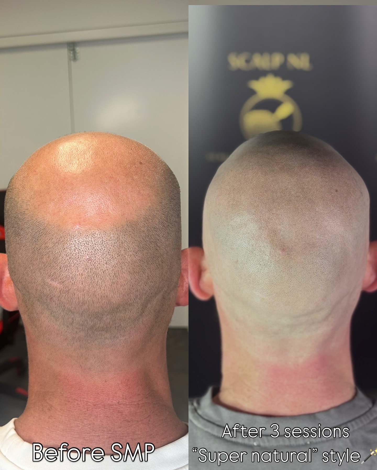 MHP resultaat Shaven Look