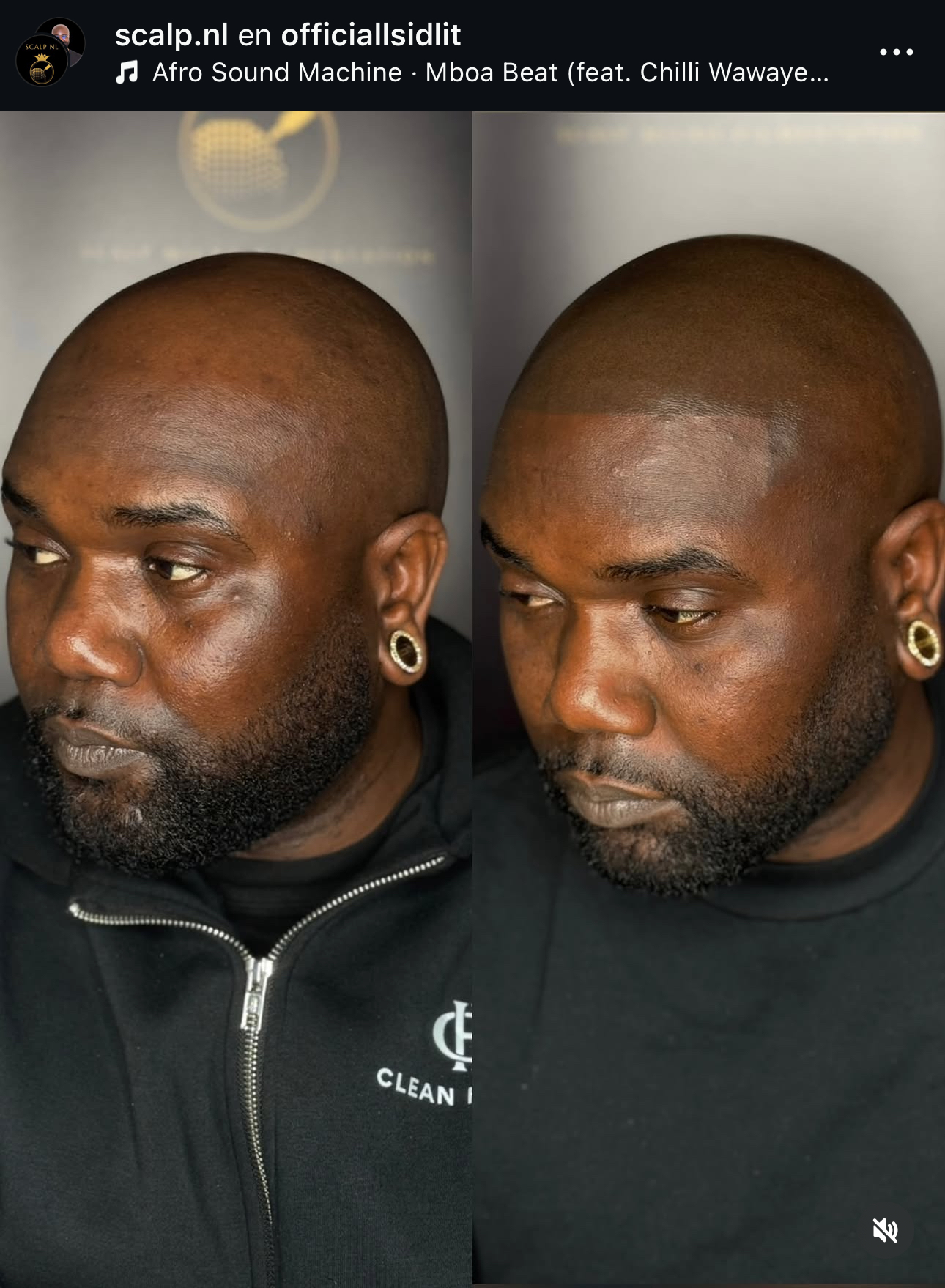 MHP resultaat Shaven Look