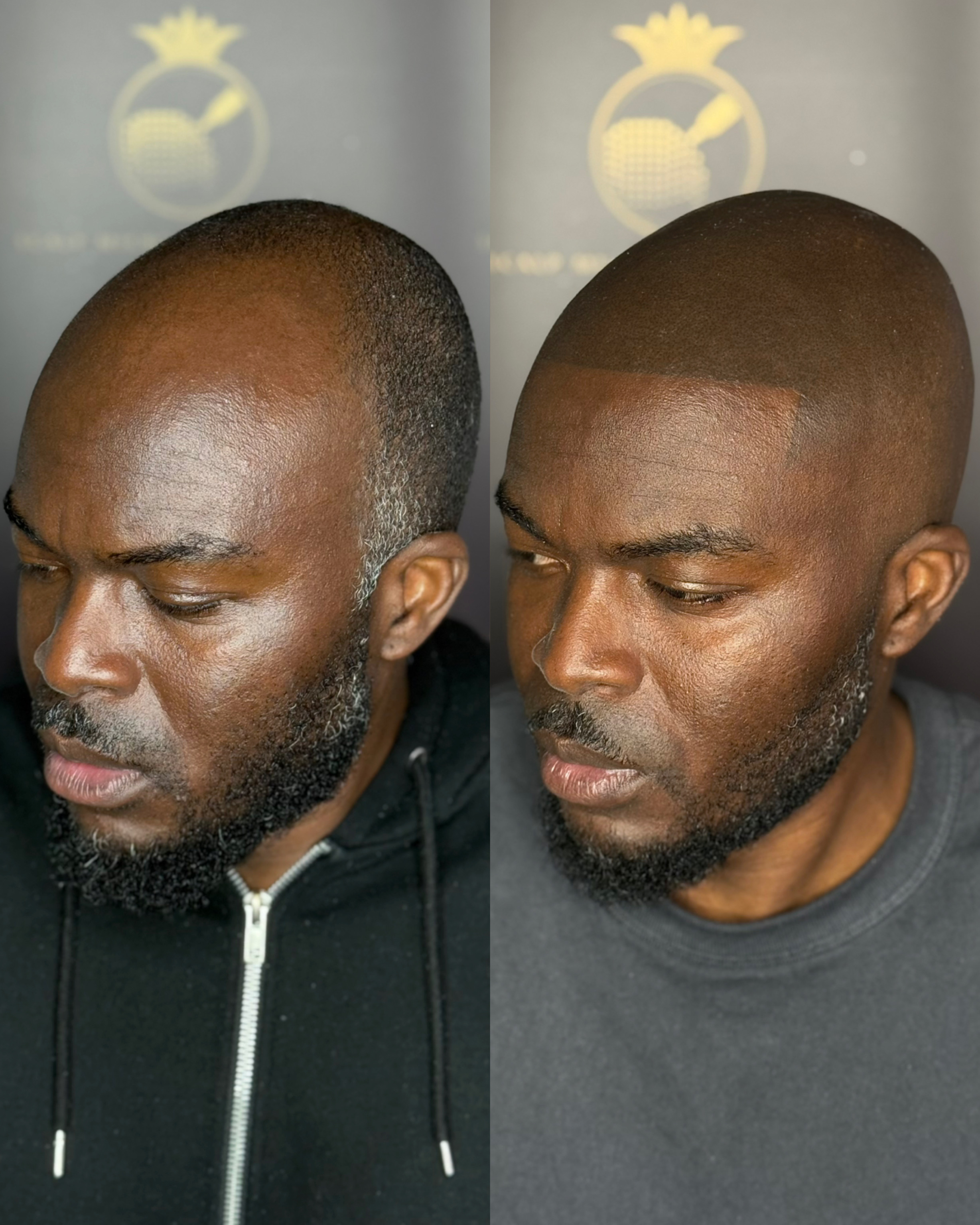 MHP resultaat Shaven Look